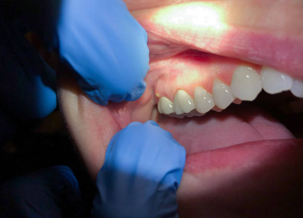 Best Tooth Infection Emergency Dentist  in Maysville, KY