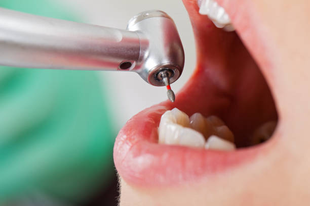 Best Cracked Tooth Emergency Dentist  in Maysville, KY